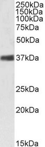 NPM1 Antibody in Western Blot (WB)