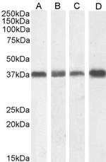 NPM1 Antibody in Western Blot (WB)