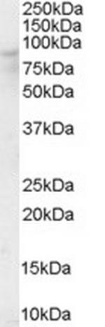 OSBP Antibody in Western Blot (WB)