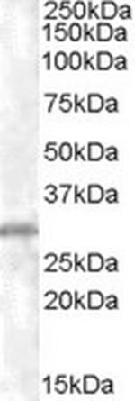 CHMP5 Antibody in Western Blot (WB)