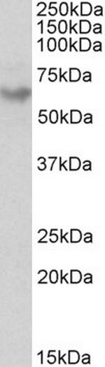 GAD65 Antibody in Western Blot (WB)