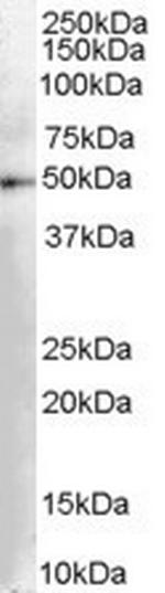 DOPA Decarboxylase Antibody in Western Blot (WB)