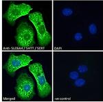 SLC6A4 Antibody in Immunocytochemistry (ICC/IF)