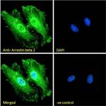 beta-Arrestin 2 Antibody in Immunocytochemistry (ICC/IF)