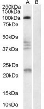 Nogo Receptor Antibody in Western Blot (WB)