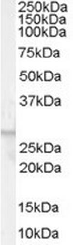 GPR40 Antibody in Western Blot (WB)