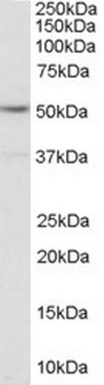 HTR2C Antibody in Western Blot (WB)