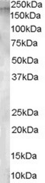 CD249 Antibody in Western Blot (WB)