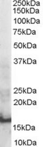 SH2D1A Antibody in Western Blot (WB)