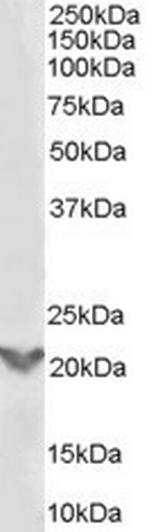 TGIF2 Antibody in Western Blot (WB)