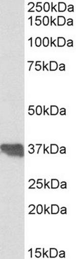 Apolipoprotein J Antibody in Western Blot (WB)