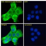 ADORA2B Antibody in Immunocytochemistry (ICC/IF)