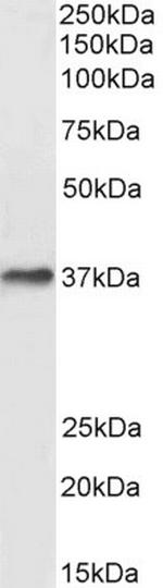 DARC Antibody in Western Blot (WB)