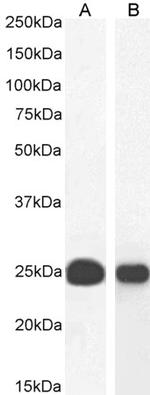 HP1 alpha Antibody in Western Blot (WB)