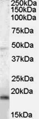 BAALC Antibody in Western Blot (WB)