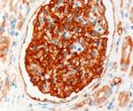 NHERF2 Antibody in Immunohistochemistry (Paraffin) (IHC (P))