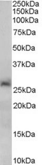 SIRT3 Antibody in Western Blot (WB)