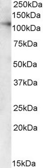 VDP Antibody in Western Blot (WB)