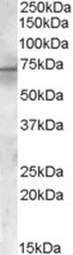 PDK1 Antibody in Western Blot (WB)