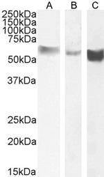 Monoamine Oxidase B Antibody in Western Blot (WB)