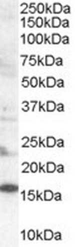 SH2D1A Antibody in Western Blot (WB)