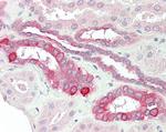 TNFRSF14 Antibody in Immunohistochemistry (Paraffin) (IHC (P))