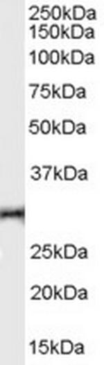 TNFRSF14 Antibody in Western Blot (WB)