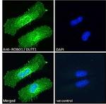 ROBO1 Antibody in Immunocytochemistry (ICC/IF)