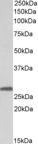 14-3-3 sigma Antibody in Western Blot (WB)