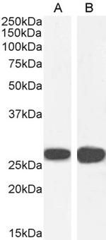 14-3-3 sigma Antibody in Western Blot (WB)