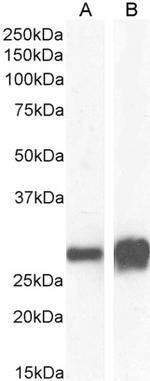 14-3-3 sigma Antibody in Western Blot (WB)