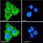 SOD1 Antibody in Immunocytochemistry (ICC/IF)