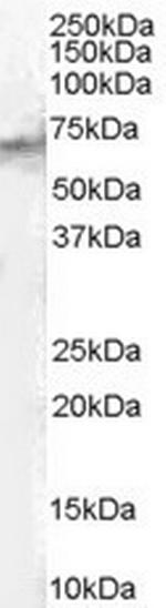 STAM2 Antibody in Western Blot (WB)