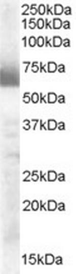 CYP17A1 Antibody in Western Blot (WB)