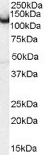 Amphiphysin Antibody in Western Blot (WB)