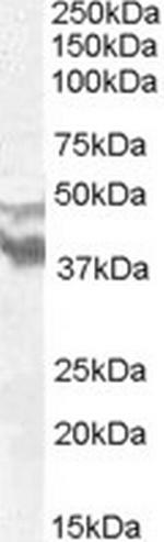 DYX1C1 Antibody in Western Blot (WB)