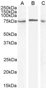 TAK1 Antibody in Western Blot (WB)