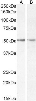 Chromogranin A Precursor Antibody in Western Blot (WB)