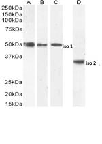 Chromogranin A Precursor Antibody in Western Blot (WB)