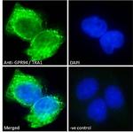 GRP94 Antibody in Immunocytochemistry (ICC/IF)