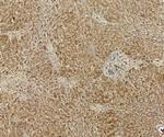 GRP94 Antibody in Immunohistochemistry (Paraffin) (IHC (P))