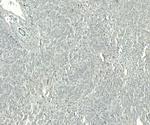 GRP94 Antibody in Immunohistochemistry (Paraffin) (IHC (P))