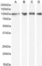 GRP94 Antibody in Western Blot (WB)