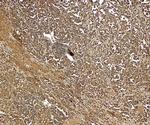 PMEL Antibody in Immunohistochemistry (Paraffin) (IHC (P))