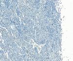 PMEL Antibody in Immunohistochemistry (Paraffin) (IHC (P))