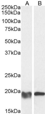 GPX4 Antibody in Western Blot (WB)