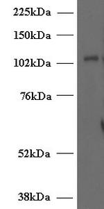 Munc13-4 Antibody in Western Blot (WB)