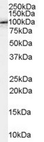 Fe65 Antibody in Western Blot (WB)