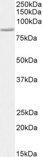 STAT3 Antibody in Western Blot (WB)