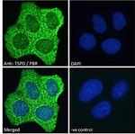 TSPO Antibody in Immunocytochemistry (ICC/IF)